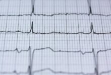 nova pulse in strategic orbit